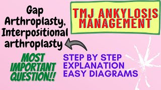 TMJ AnkylosisManagementGAP ARTHROPLASTYStep by step explanationImportant question [upl. by Adianez790]