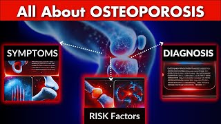 OSTEOPOROSIS Symptoms Risk Factors and Diagnosis Explained 2024 Update [upl. by Atipul630]