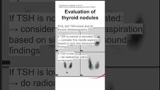 Evaluation of thyroid nodules [upl. by Agnola480]