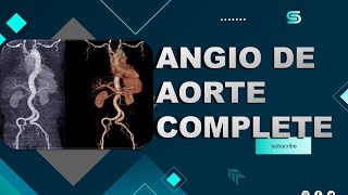 angio tdm de laorte complete [upl. by Hareema]