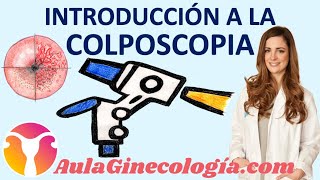 INTRODUCCIÓN a la COLPOSCOPIA MATERIALES ÁCIDO ACÉTICO LUGOL  Ginecología y Obstetricia [upl. by Franza678]