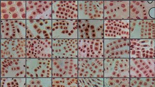 2 ACETICACETO ORCEIN STAINED ONION ROOT TIP CELL DIVISION STAGES [upl. by Trask447]