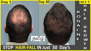 Rogaine Minoxidil for Hair Regrowth in 30 days  Where to buy Rogaine in India  Mens Fashion Tamil [upl. by Curcio177]