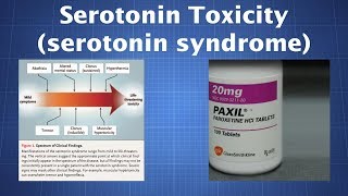 Overdosing on Serotonin What to Know About Serotonin Toxicity [upl. by Nodab]