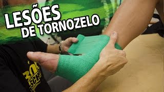 Como tratar lesões de tornozelo Fisioterapia Esportiva  RTF 111 [upl. by Durst]