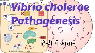 Vibrio cholerae  Pathogenesis amp clinical manifestations [upl. by Tinaret]