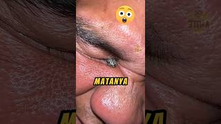 Ada Benda Aneh Di MATA Orang Ini❗😱 videoviral binatang videoshort [upl. by Noremmac]