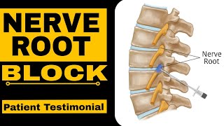 Nerve Root Block Patient Testimonial [upl. by Essenaj]