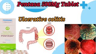 Pentasa 500Mg Tablet UseBenefitsSide EffectsUlcerative Colitis TreatmentFull Reviews [upl. by Radmen679]