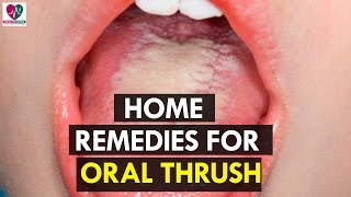 Home Remedies for Oral Thrush  health Sutra [upl. by Burner848]