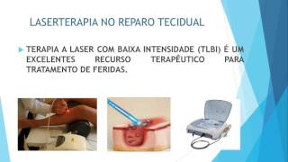 LASERTERAPIA NO REPARO TECIDUAL JOELITA e MARIANA [upl. by Lathan]