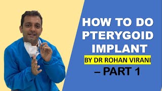 HOW TO DO PTERYGOID IMPLANT BY DR ROHAN VIRANI – PART 1 [upl. by Jill]