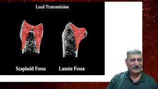 Novel Technique of Fixation of Distal Radius  Traumacon 2024  By Dr Navin Thakkar [upl. by Leeke486]