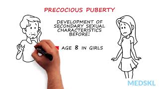 Pediatrics – Abnormal Pubertal Development By Paola Luca MD [upl. by Meesak]