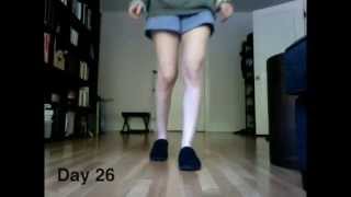 Walking After ORIF Ankle Surgery Month 1 [upl. by Lyle]