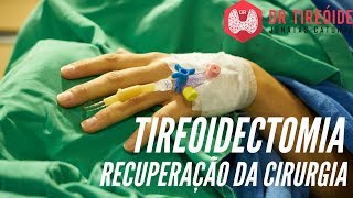 Como é a recuperação da tireoidectomia  Dr Jônatas Catunda [upl. by Nodyarg]