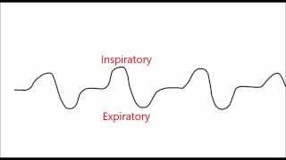 CPAP and BiLevel What is EPR Aflex and Cflex [upl. by Argus]