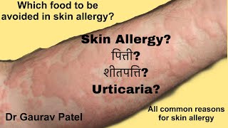 Skin allergy in hindi urticariaपित्ती शीतपत्ति causesfood and other allergen Dr Gaurav patel [upl. by Nehepts708]