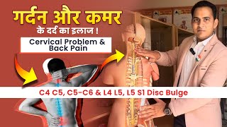 FullVideo👉C4 C5 C5C6 amp L4 L5 L5 S1 Disc Bulge  गर्दन और कमर के दर्द का इलाज Cervical amp Back Pain [upl. by Adelheid106]