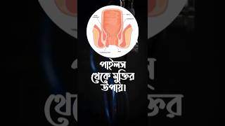 পাইলস থেকে মুক্তি  Nitricum Acidum  piles পাইলস [upl. by Nevaed]