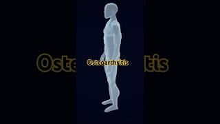 Osteoarthritiscausestreatment osteoarthritis viralshorts 3danimation crazypharmaguruji [upl. by Askwith]