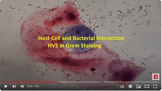 Host Cell and Bacterial Interaction I HVS in Gram Staining [upl. by Areic342]