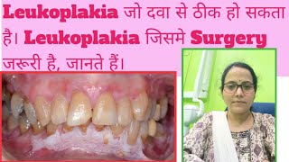 White Patch in mouthLeukoplakia amp its typesWhich Leukoplakia is dangerous amp transform to Cancer [upl. by Eiral719]