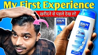 Best Dandruff Shampoo for Men  Scalpe Pro Anti Dandruff Shampoo Review⚡Daily Anti Dandruff Sampu 😇 [upl. by Rowe]