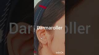 derma roller shortvideo skincare beautiproduct skincareproduct makeup [upl. by Lemart]