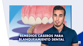 ¿Qué es la fluorosis dental [upl. by Aenej997]