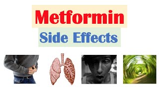 Metformin Side Effects amp Consequences [upl. by Gisella215]