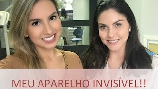 Como funciona o aparelho invisível [upl. by Naanac]