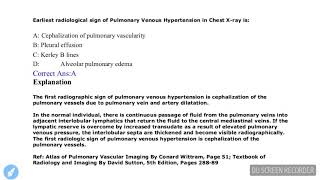 Questions on Radiological Signs  Radiology part 1 for NEET PG  USMLE and all medical PG exams [upl. by Aserehc]