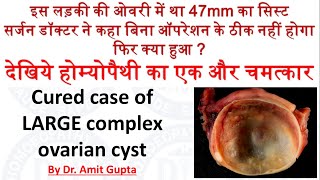 Complex Ovarian Cyst cured case Large Hemorrhagic Cyst complication of complex ovarian cyst [upl. by Loni]