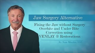 NonSurgical Overbite amp Underbite Fix with VENLAY® Restorations [upl. by Othilia431]