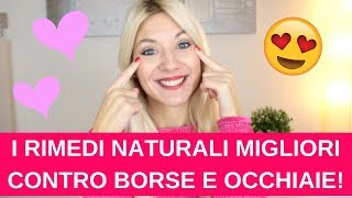 6 RIMEDI NATURALI DAVVERO EFFICACI contro BORSE e OCCHIAIE [upl. by Nylyaj960]