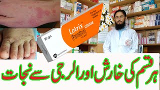 Lotrix Cream is used for the treatment controlfollowing diseases Itchiness Scabies by Dr Nawaz [upl. by Pihc]