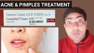 comedolytic cream use in hindi [upl. by Akeemahs]