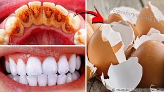 Can you whiten teeth at home in 2 minutes 😁✨ Secret that Dentists dont want you to know [upl. by Ivanah284]