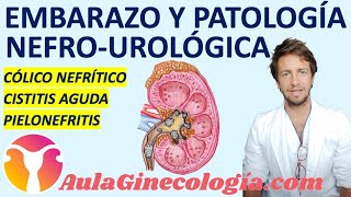 EMBARAZO Y PATOLOGÍA UROLÓGICA CÓLICO CISTITIS PIELONEFRITIS  Ginecología y Obstetricia [upl. by Inanaup]