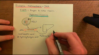 Diabetes Mellitus and Antidiabetic Drugs Part 6 [upl. by Grove]