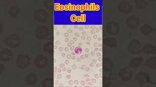 Eosinophils cells  Blood smear  Blood smear microscopy  shorts trendingshorts viral lab [upl. by Rocher]