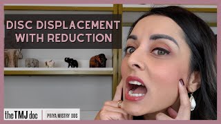 Disc Displacement With Reduction  Priya Mistry DDS the TMJ doc tmj jawpopping jawclicking [upl. by Siraval]