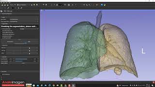 Video Tutorial Segmentación de Tórax por Tomografía Estación de Trabajo 3D Slicer 1080 [upl. by Rodi626]