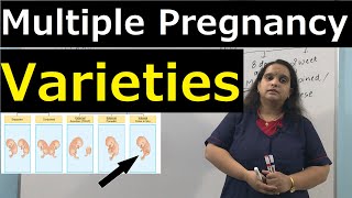 Multiple Pregnancy Varieties amp Incidences  Nursing Lecture [upl. by Nitsraek]