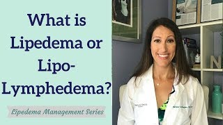 What is Lipedema and Lipo Lymphedema  Part 1 Lipedema Management Series [upl. by Suilenroc564]