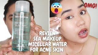 SEA MAKEUP MICELLAR WATER FOR ACNE SKIN REVIEW [upl. by Sekyere462]