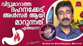 വിട്ടുമാറാത്ത ദഹനക്കേട് അൾസർ ആയി മാറുന്നത് എങ്ങനെ [upl. by Ekal]