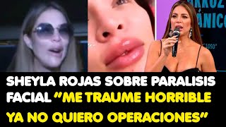 SHEYLA ROJAS SOBRE PARALISIS FACIAL “ME TRAUME HORRIBLE YA NO QUIERO OPERACIONES” [upl. by Esli]