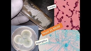 Study of fungi  Yeast and mold [upl. by Nnahaid]